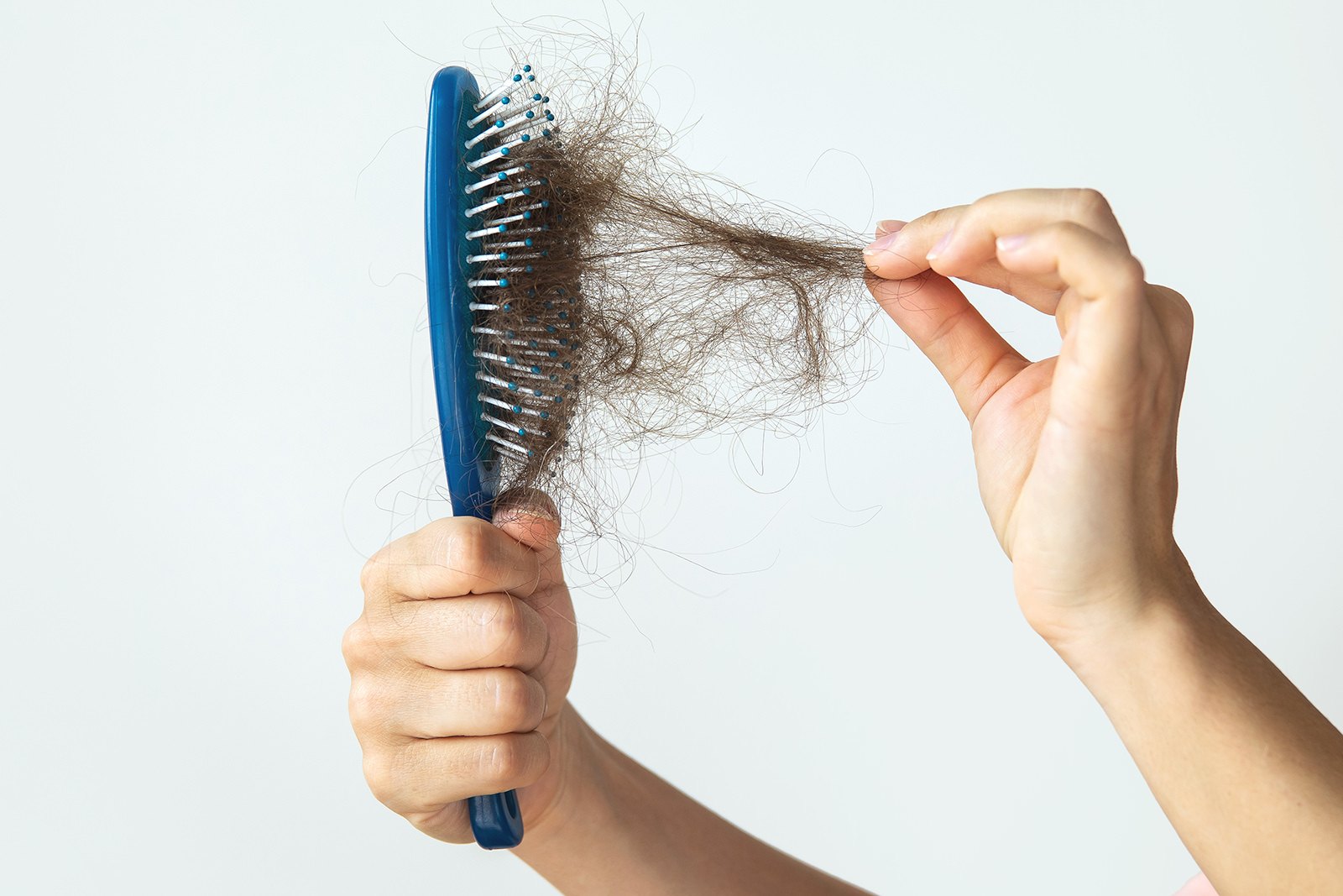 The 5 Most Common Causes of Hair Loss Explained