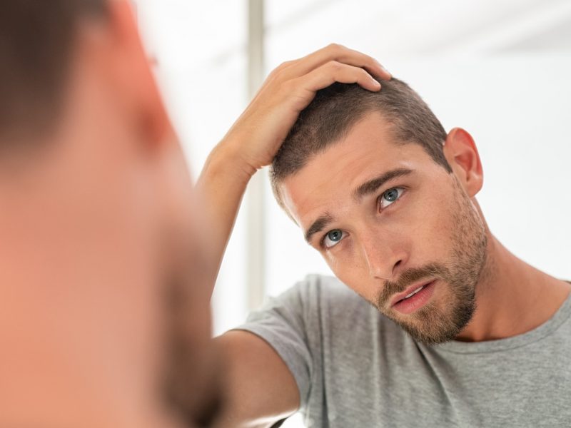 Everything You Need to Know About an FUT Hair Transplant