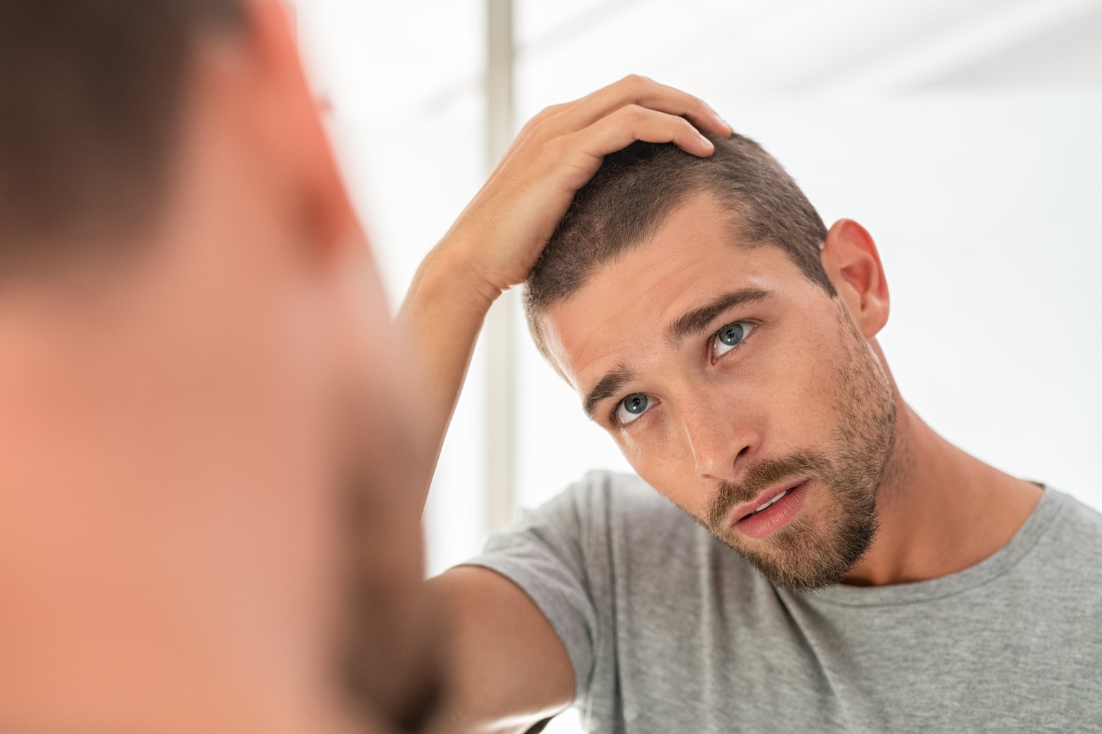 Everything You Need to Know About an FUT Hair Transplant